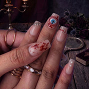 Stitched Wound